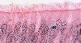 เยื่อบุผิวเสาธรรมดา ciliated