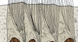 เยื่อบุผิวเสาธรรมดา ciliated