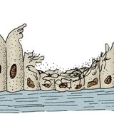 เยื่อบุผิว ciliated ในระบบทางเดินหายใจของผู้สูบบุหรี่