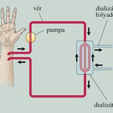 Művesekezelés