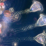 Vorticella (โปรโตซัวน้ําจืด)
