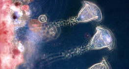 Vorticella (โปรโตซัวน้ําจืด)