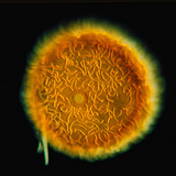 ฟองน้ำ Gemmule (Spongilla lacustris)