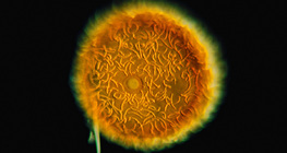 ฟองน้ำ Gemmule (Spongilla lacustris)