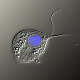 สาเหตุเชิงสาเหตุของ Trichomonas vaginalis (ภาพความคมชัดการรบกวนที่แตกต่างกัน, นิวเคลียสเป็นสีน้ำเงิน)