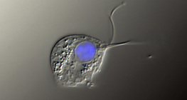 สาเหตุเชิงสาเหตุของ Trichomonas vaginalis (ภาพความคมชัดการรบกวนที่แตกต่างกัน, นิวเคลียสเป็นสีน้ำเงิน)