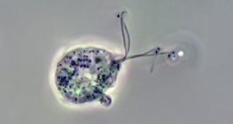 สาเหตุเชิงสาเหตุของ Trichomonas vaginalis (ภาพคอนทราสต์เฟส)