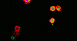 ฮีโมไซต์ Drosophila (สีแดงย้อมสี) กินแบคทีเรีย (สีเขียวย้อมสี)