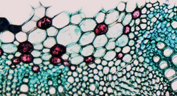 เนื้อเยื่อพืชหลอดเลือดมีลักษณะอย่างไร
