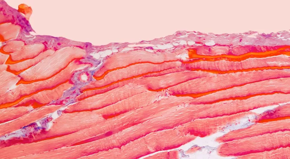 เนื้อเยื่ออะไรประกอบเป็นกล้ามเนื้อของเรา