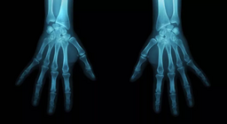 เป็นนักมานุษยวิทยานิติเวช