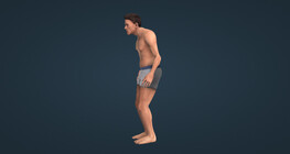 Ankylosing spondylitis (ankylosis of the spine and sacroiliac (SI) joints)