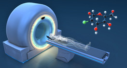How does it work? - PET-CT