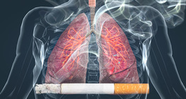 Effects of smoking on the lungs