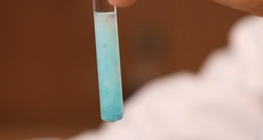 การสูญเสียโปรตีน