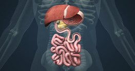 Gallstones