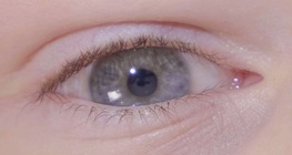 การสะท้อนแสงของรูม่านตา